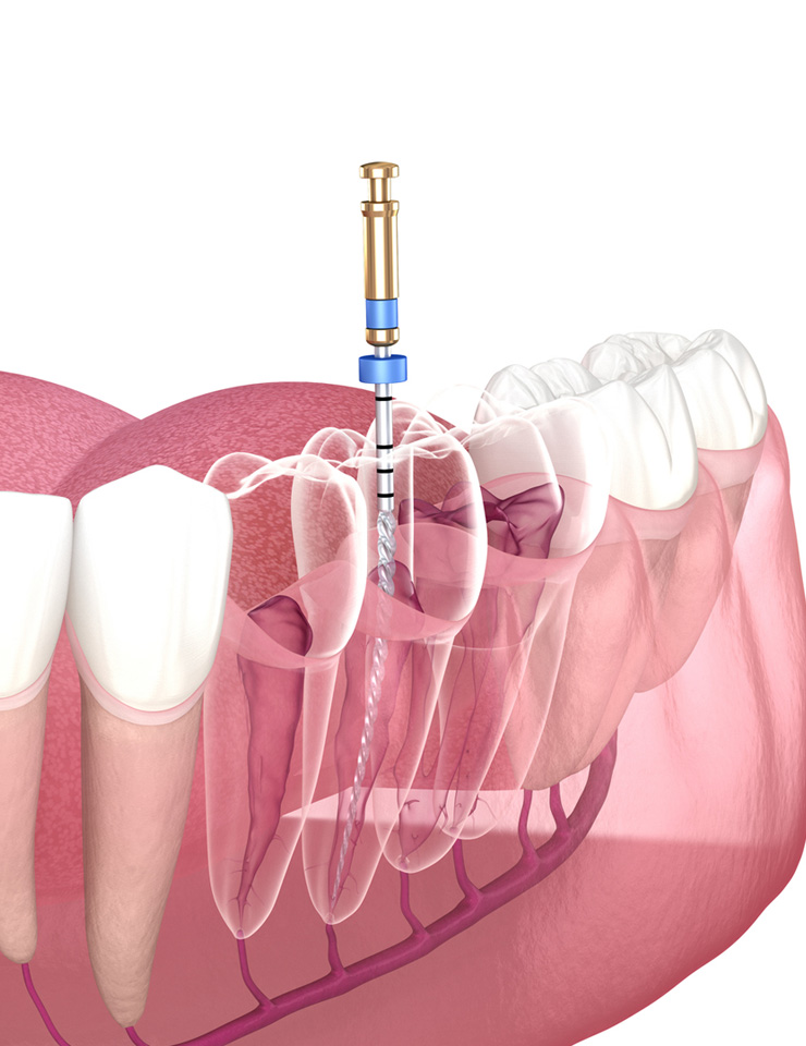 Endodontics