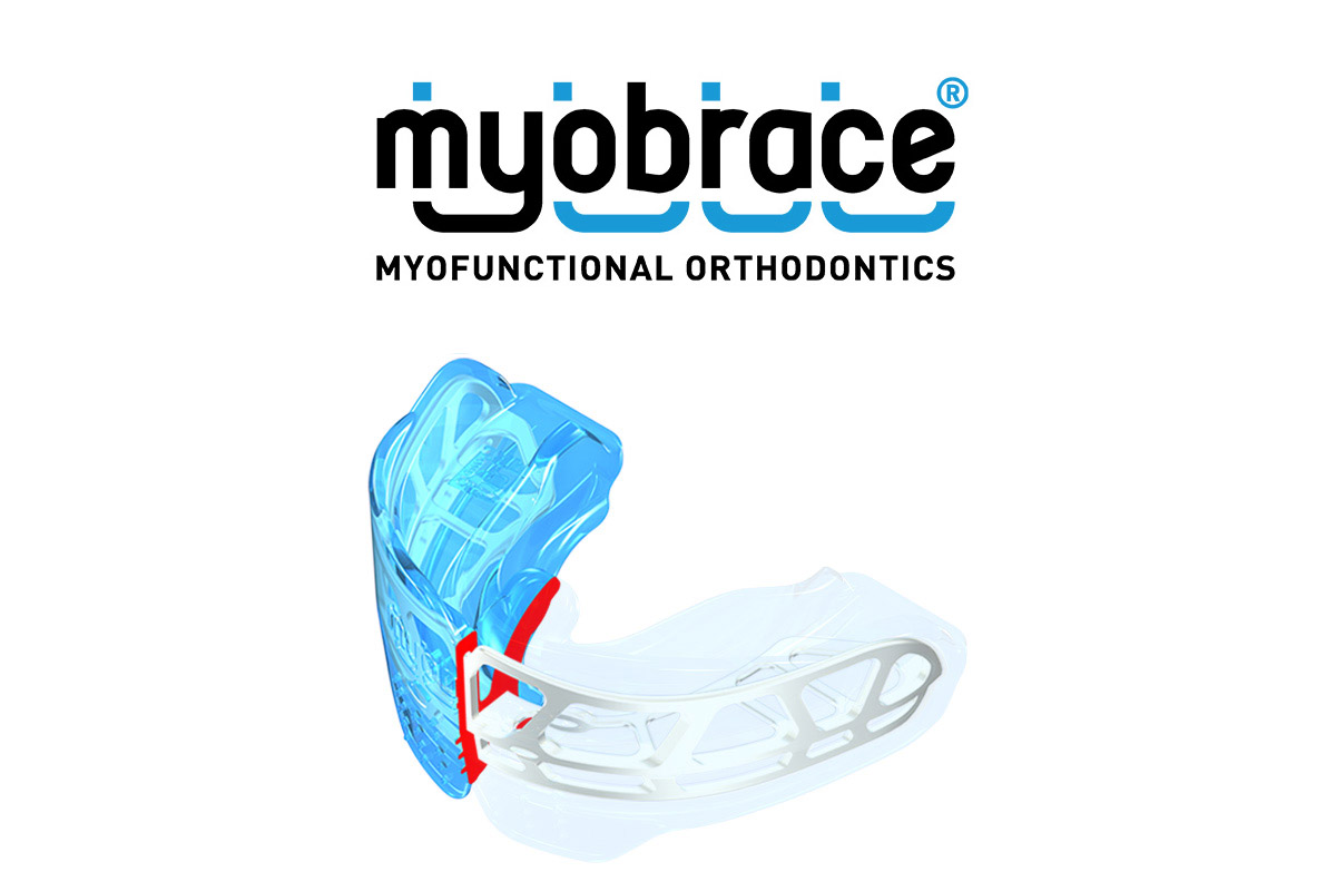 Myobrace apparecchio mobile per bambini