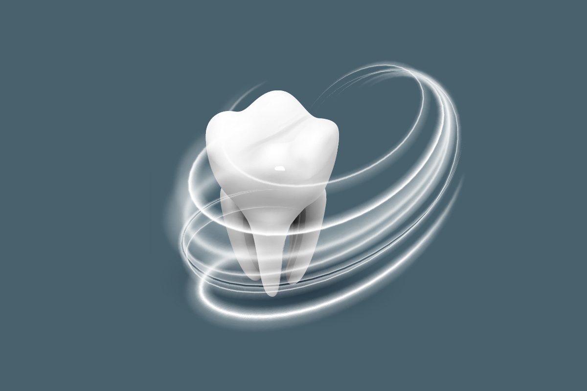 Estrazione dei denti